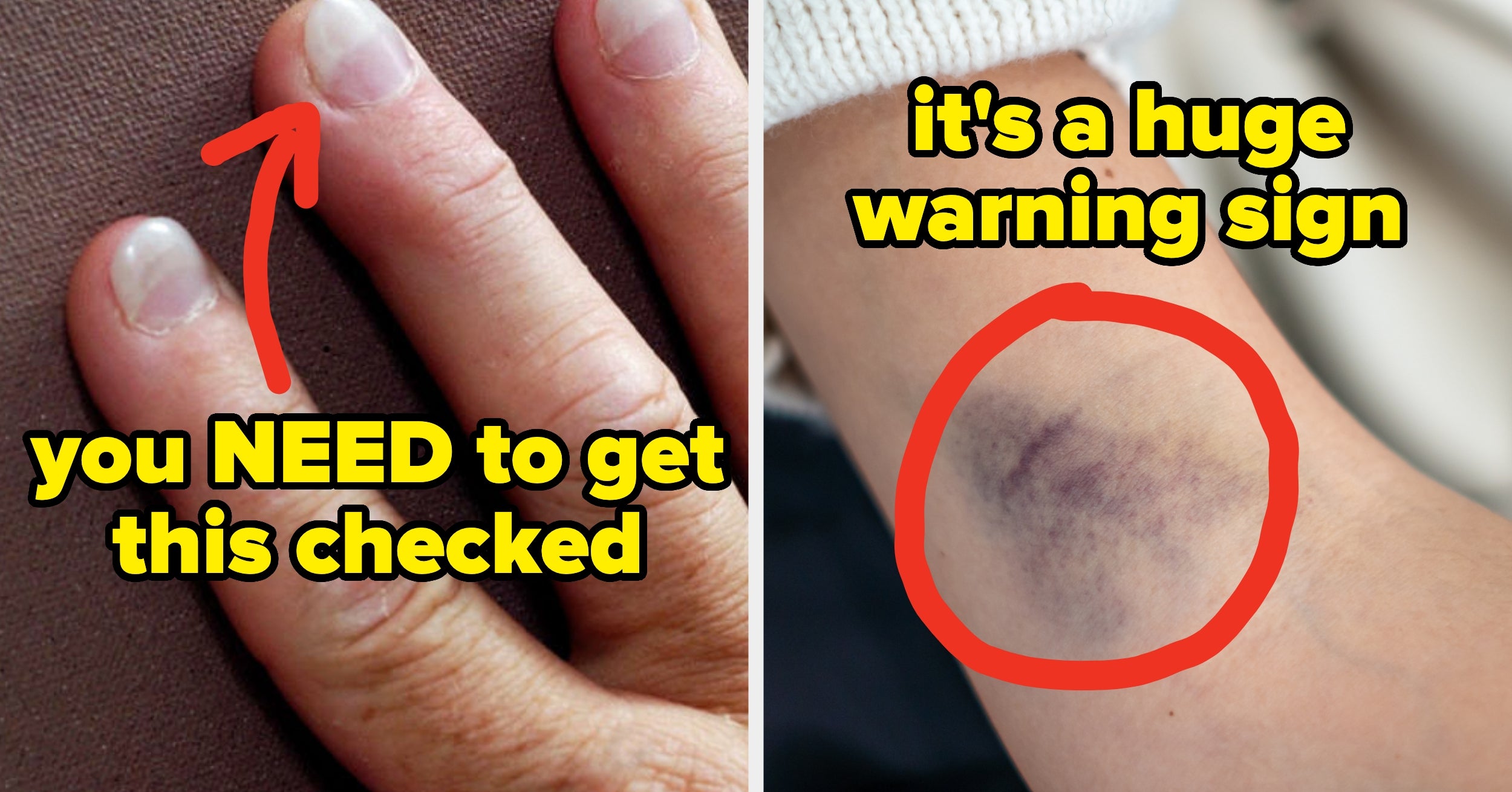 50 Health Warning Signs You Should Never, Ever Ignore, Straight From Doctors And Nurses