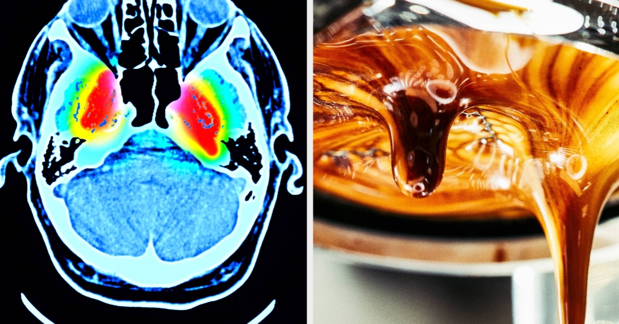 "Coffee And Tea Lovers, Rejoice": Experts Are Linking Caffeinated Drinks With A Lower Risk Of Dementia