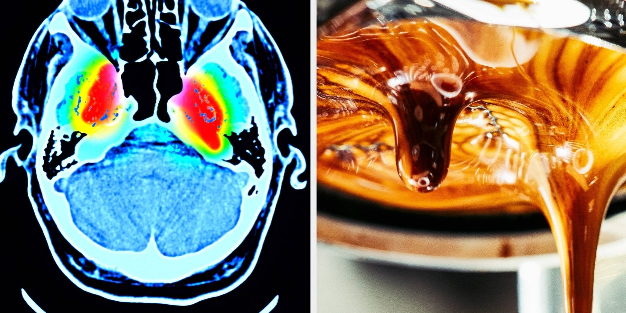 Study Links These Beverages To Lower Dementia Risk