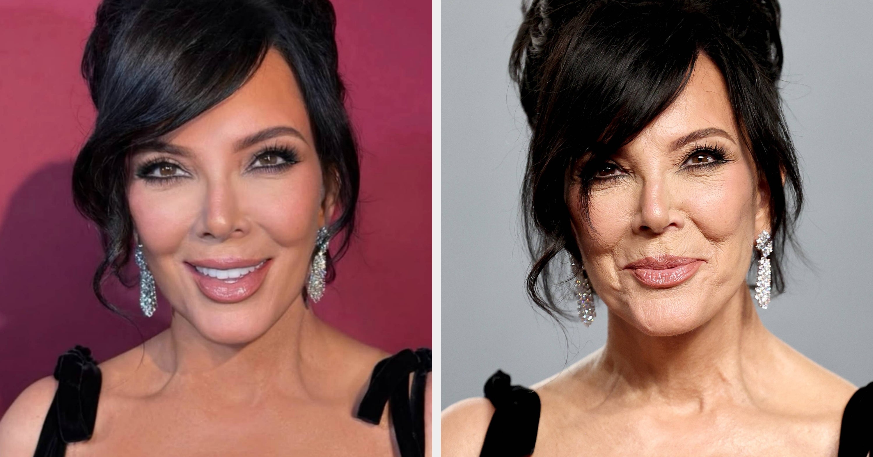 Here’s What A Board-Certified Physician Had To Say About The “Perils Of Photoshop” After Comparing Kris Jenner’s Instagram Selfies With Her Unedited Red Carpet Pictures