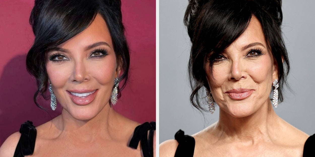 Kris Jenner's Edited Pictures: Doctor Weighs In