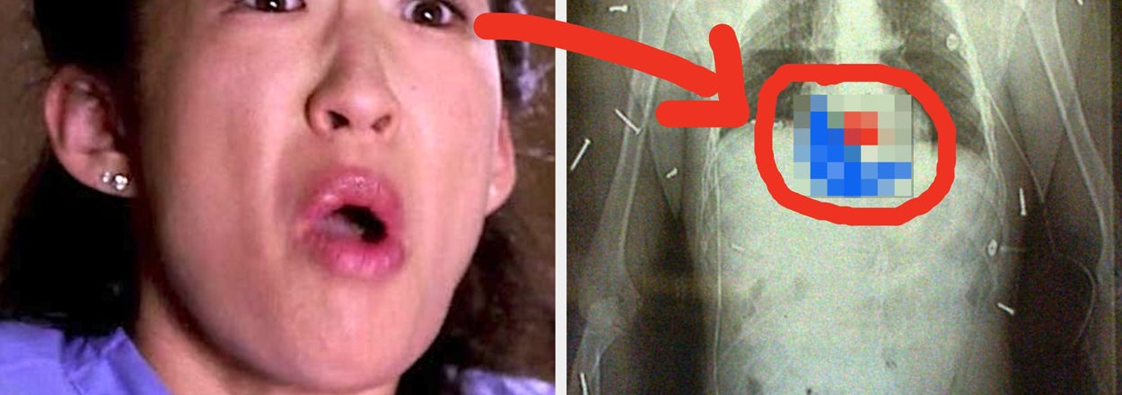 Surgeons Are Revealing The 21 Wildest Moments They've Ever Had In The Operating Room