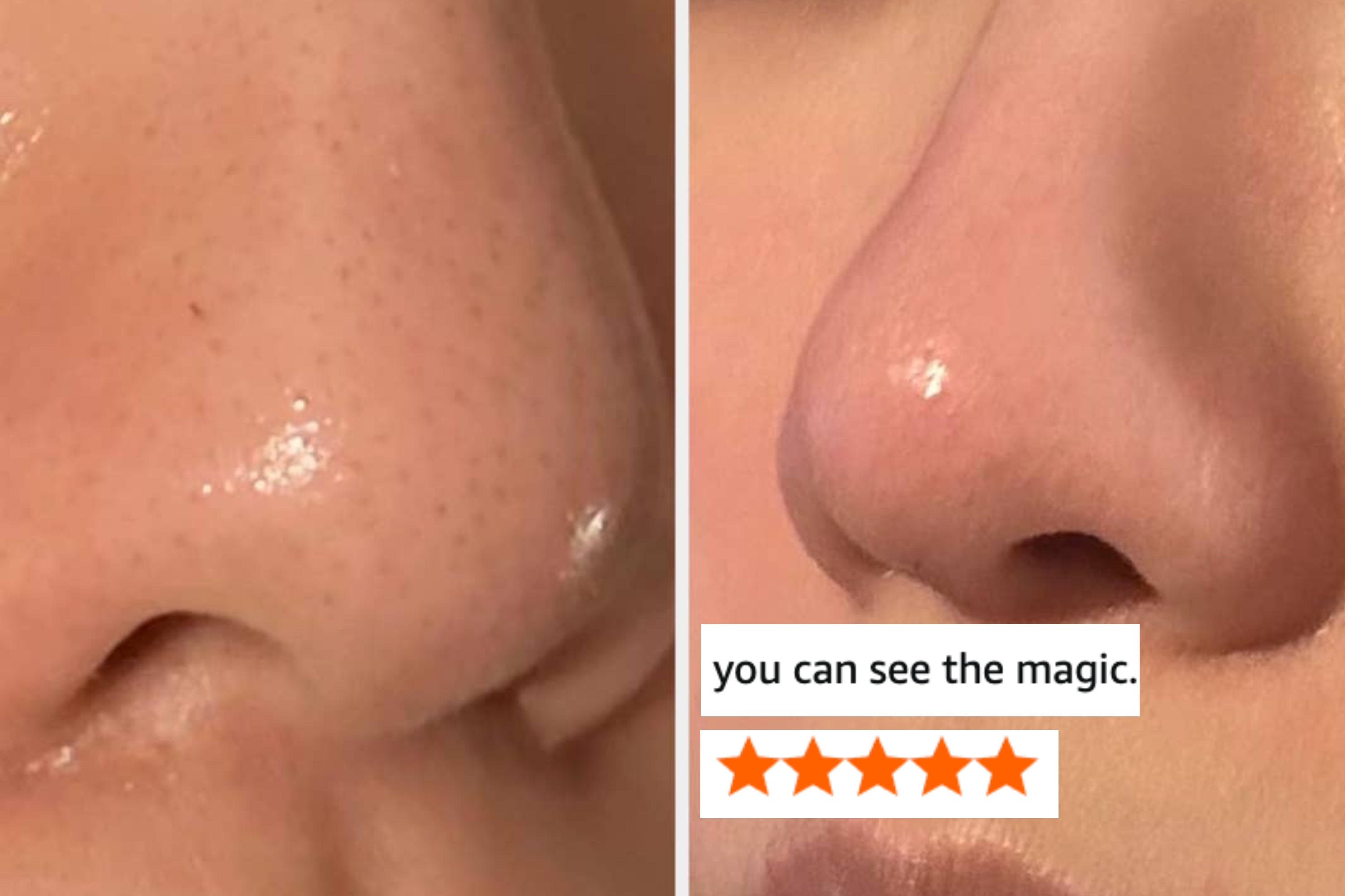 You'll Actually Look Forward To Using These 36 Personal Care Products — That's How Effective They Are