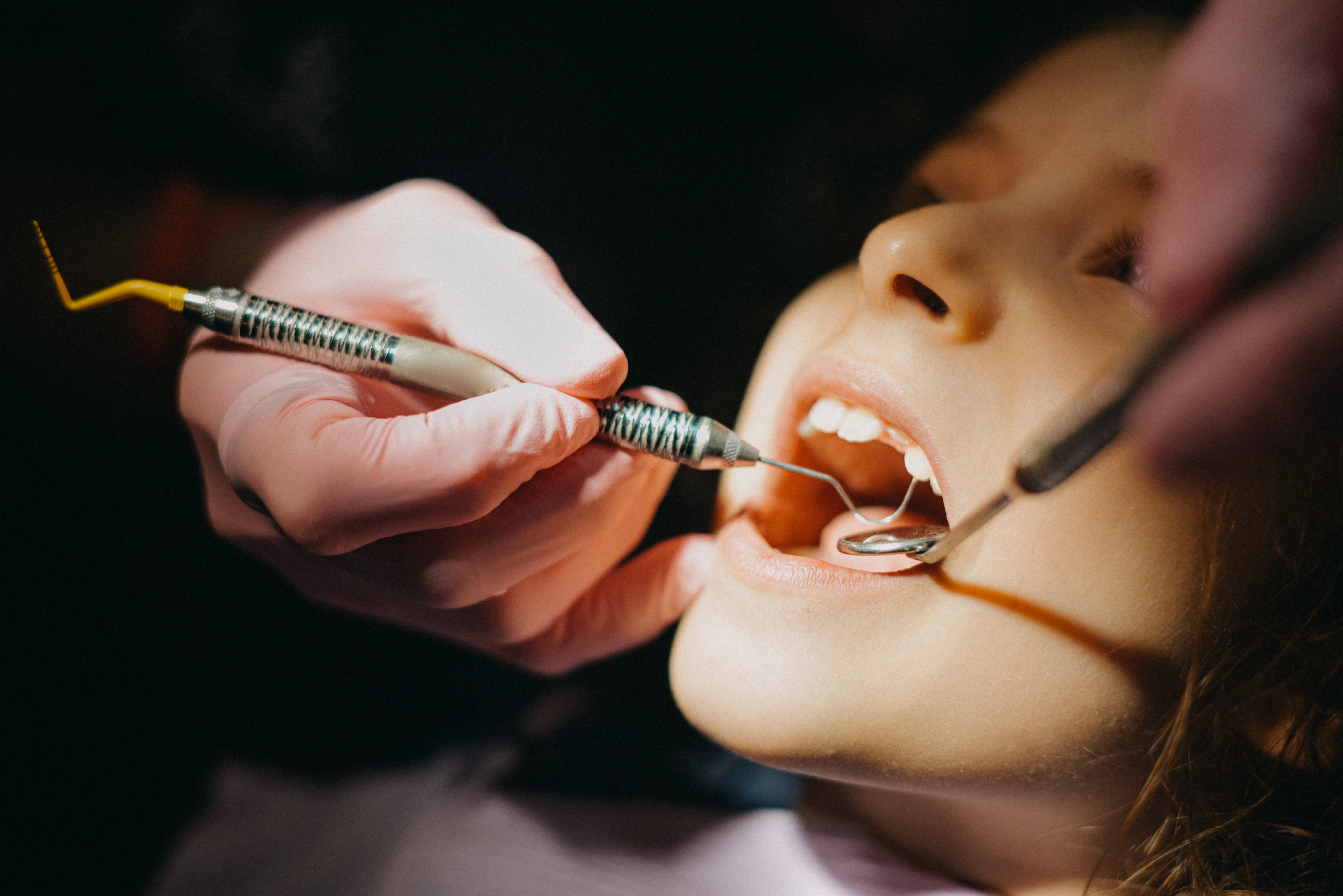 Child astatine  dentist receiving dental check-up, rima  unfastened  wide, dentist utilizing dental tools