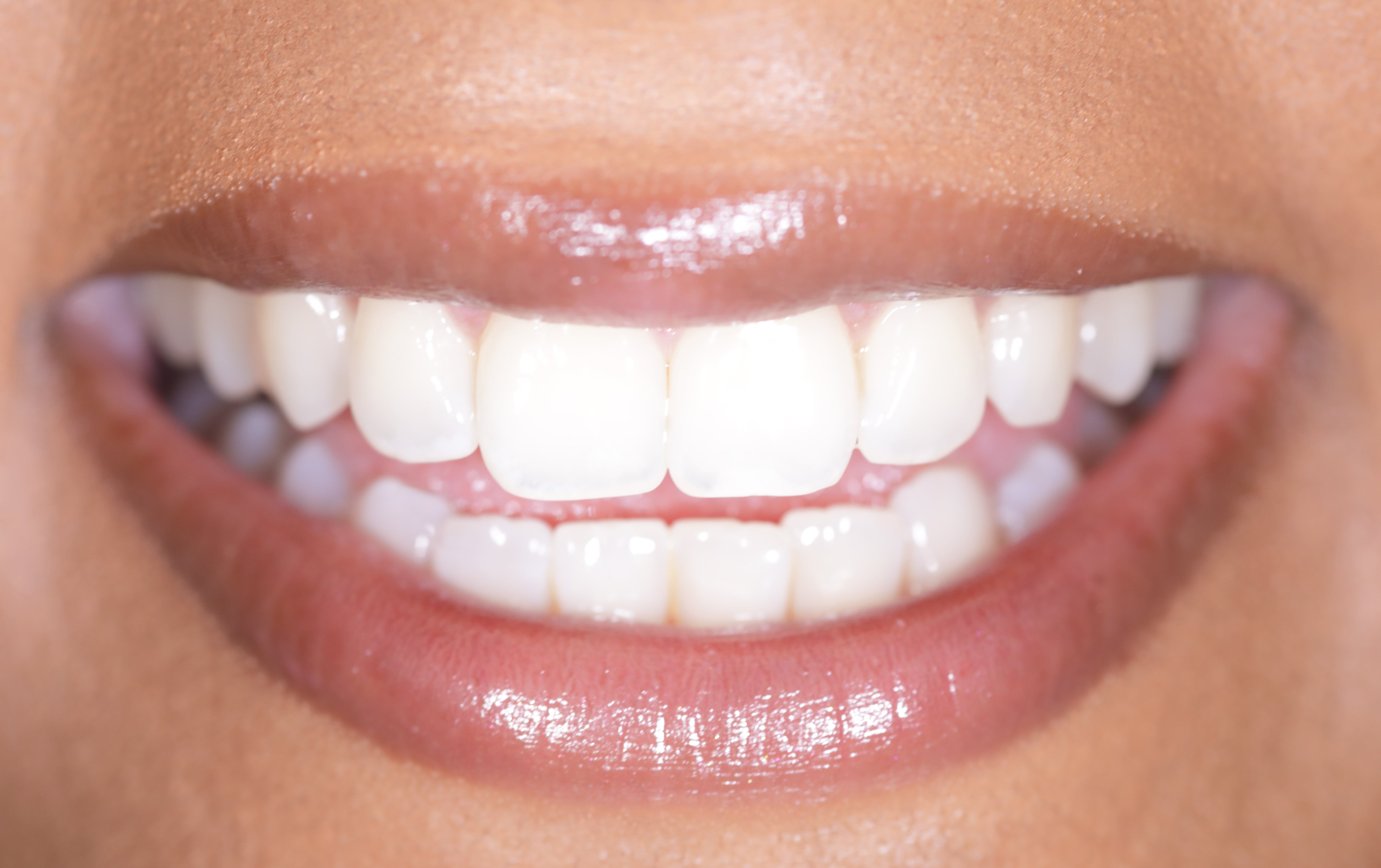 Close-up of a idiosyncratic   smiling, showing teeth and lips