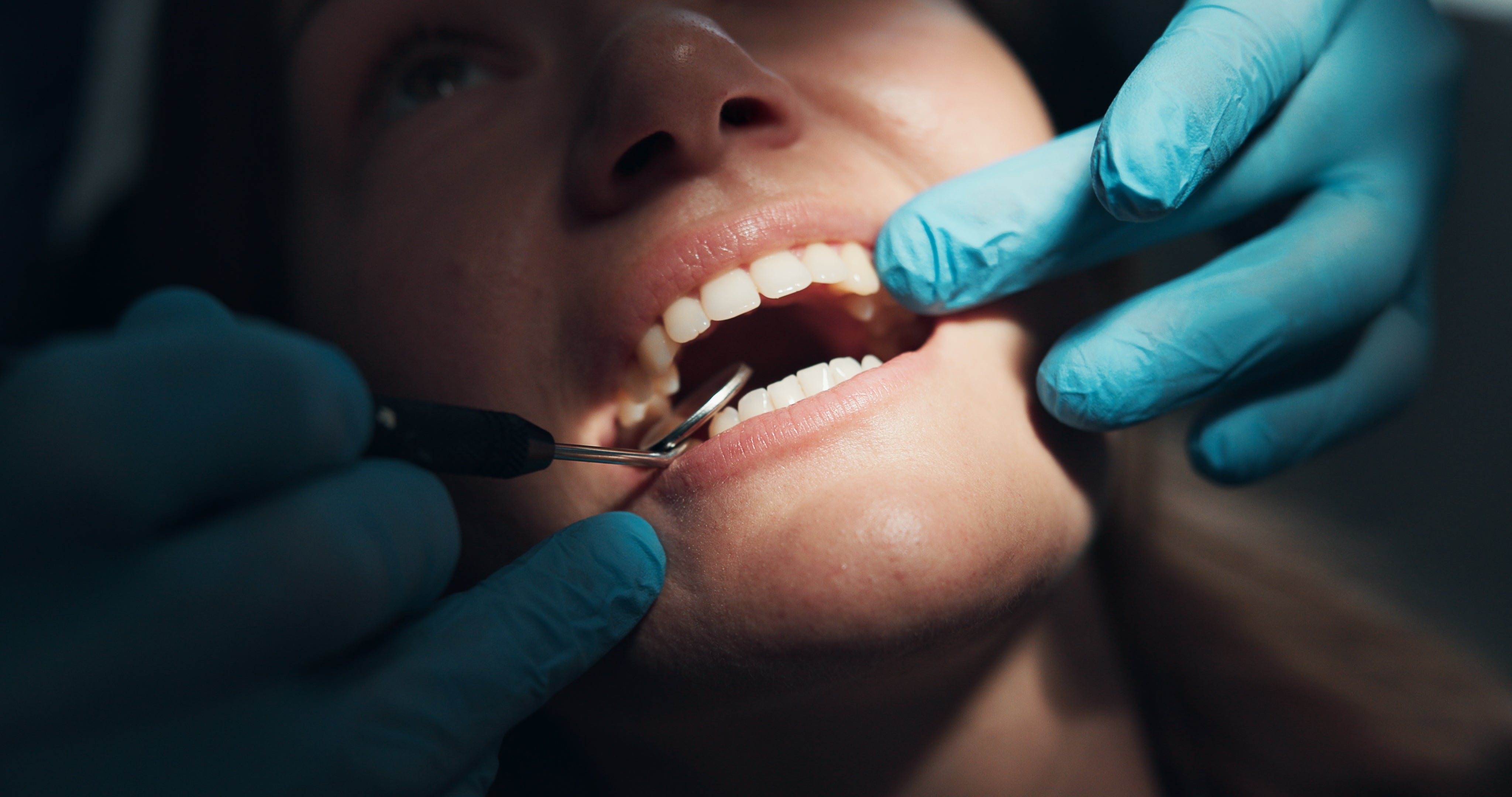 Person receiving dental check-up, with gloved hands utilizing tools to analyse   teeth