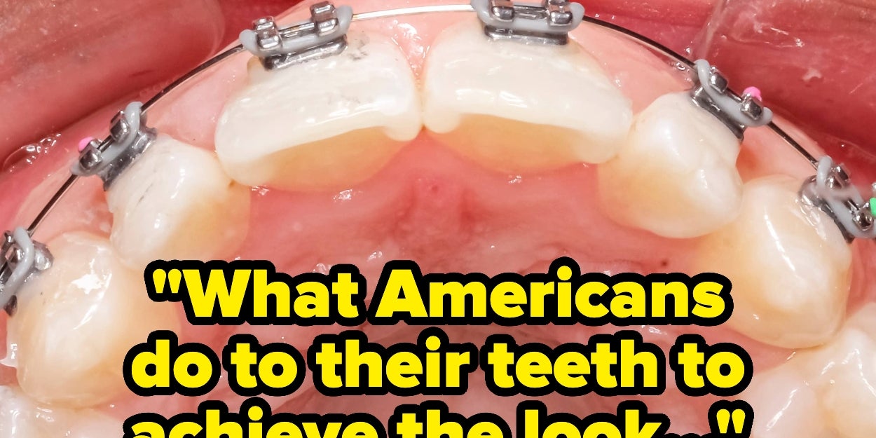 Why Your American Smile May Creep Out Foreigners