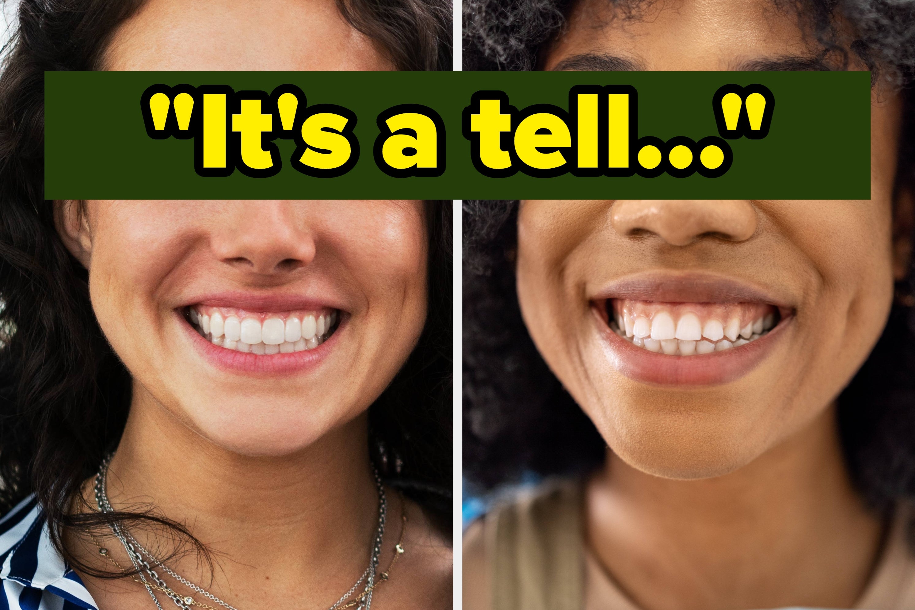 Apparently, People Abroad Can Tell You're American Just By Your Teeth. Here's How