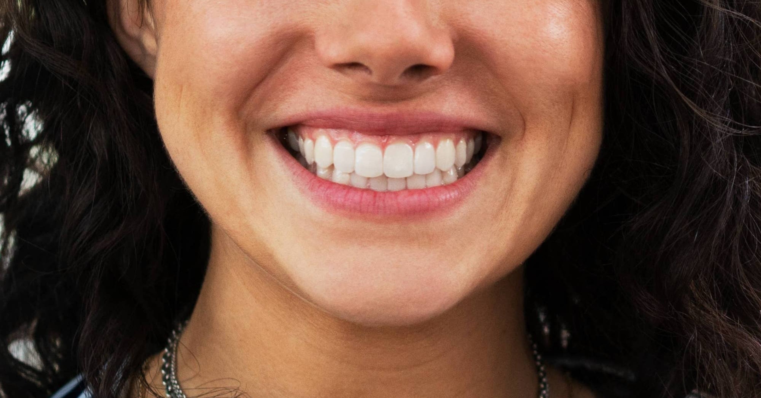 "Slightly Suspicious": Turns Out, Dentists In Other Countries Are Seriously Put Off By American Teeth
