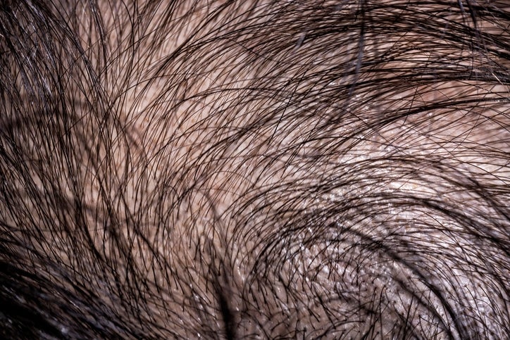 Post image 9