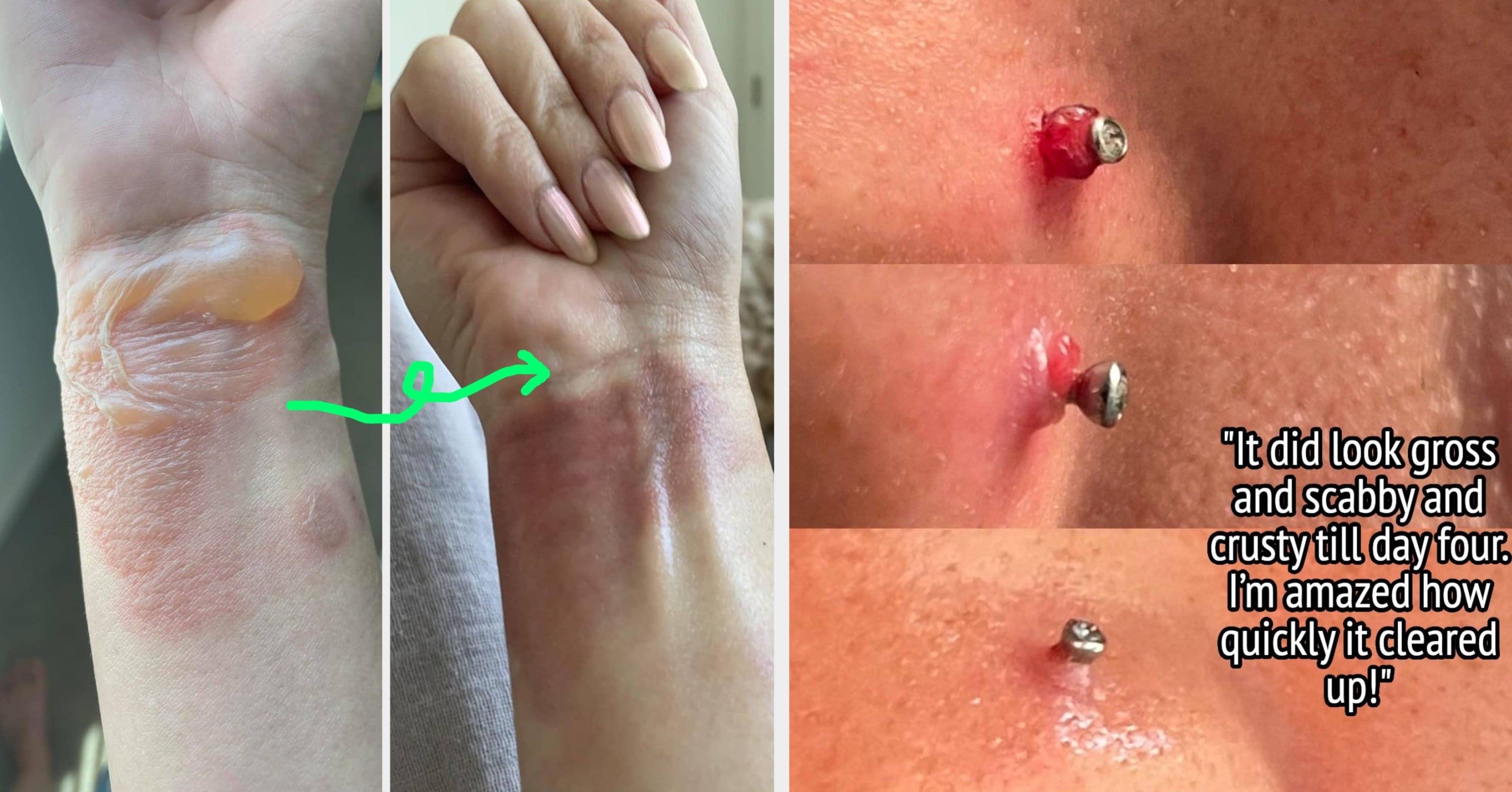 Do *Not* Click This Post If You’re Squeamish: 17 Personal Care Products With Gnarly Before And After Photos