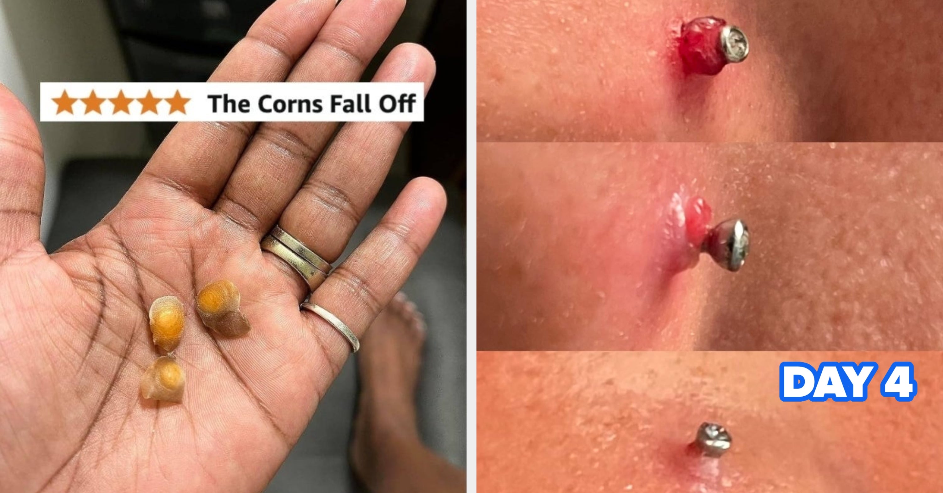 If You Love A Good Before And After Photo, Check Out These 17 Personal Care Products