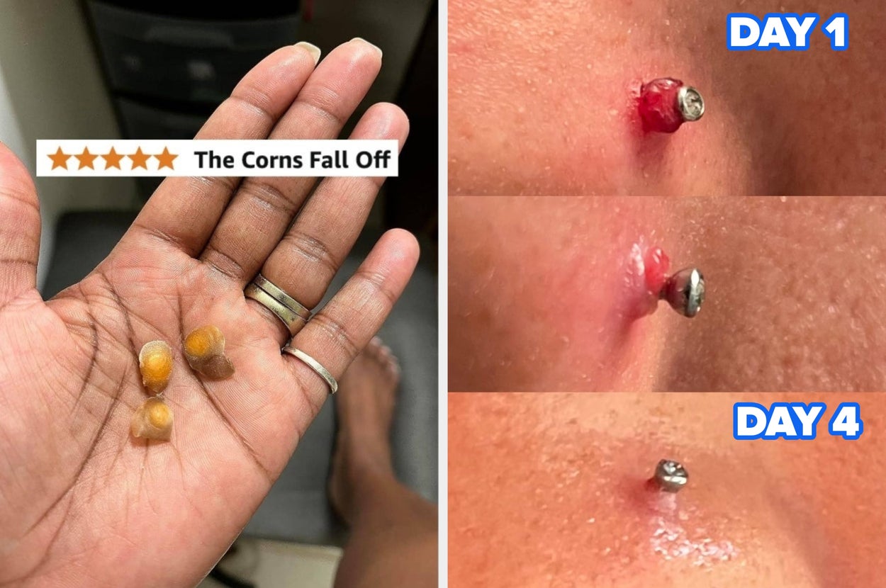 Do *Not* Click This Post If You’re Squeamish: 17 Personal Care Products With Gnarly Before And After Photos