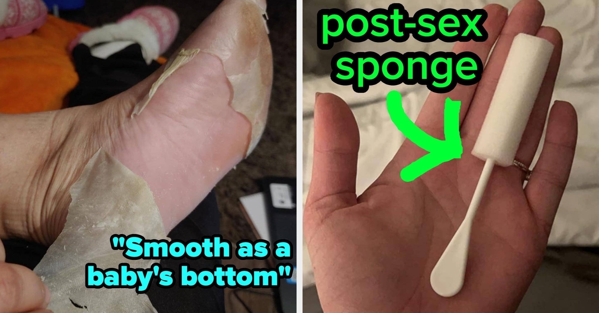 35 Products For Those Bodily Issues I Promise You Other People Deal With, Too