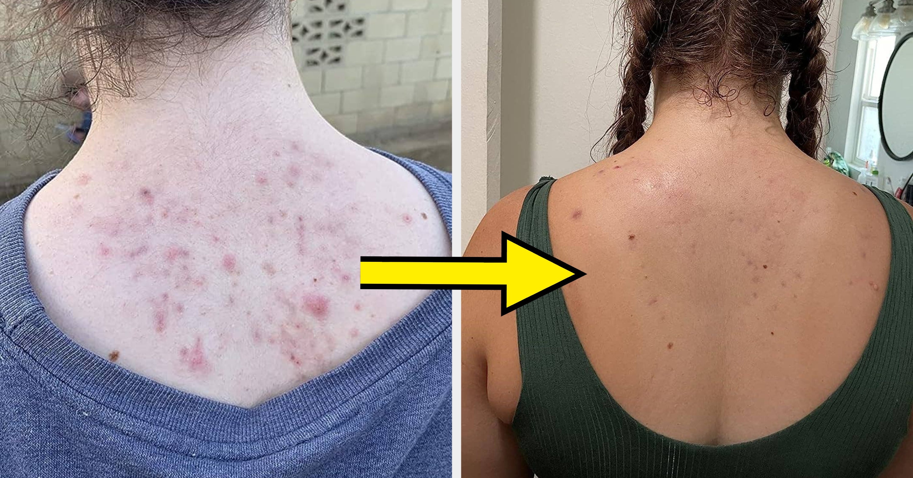27 Skincare Products Reviewers Say They’ll Use For The Rest Of Their Lives (Or Until They’re Discontinued, At Least)