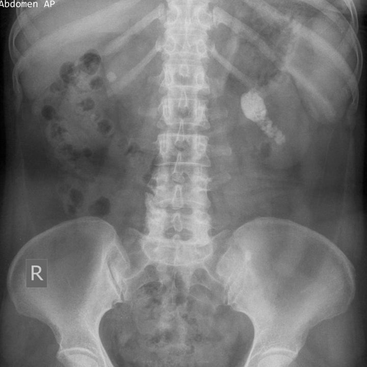 Post image 16