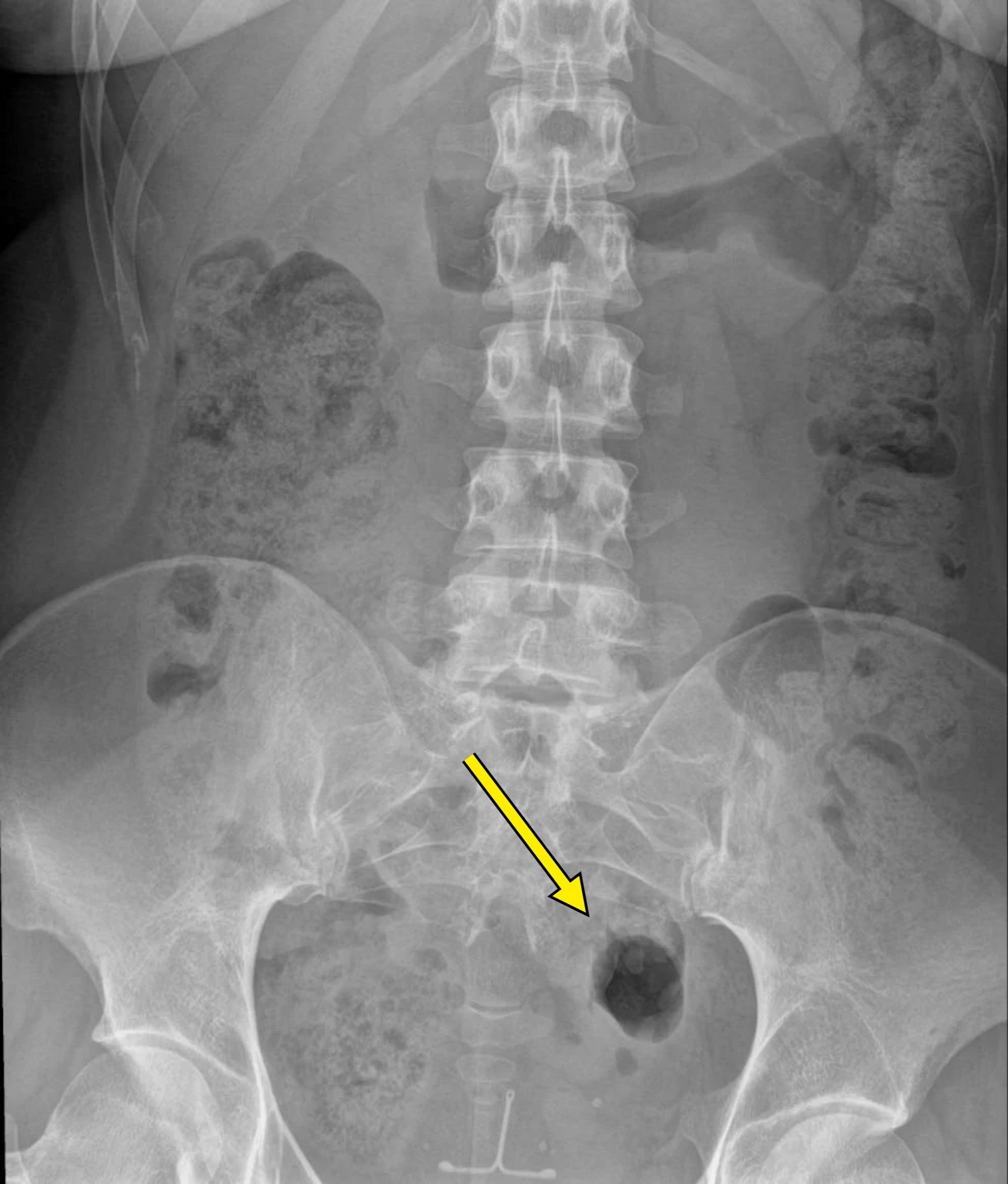 Post image 8