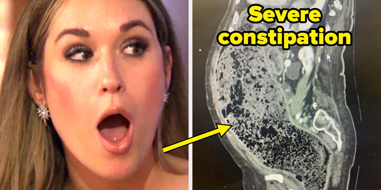 66 Utterly Fascinating Photos Of The Human Body