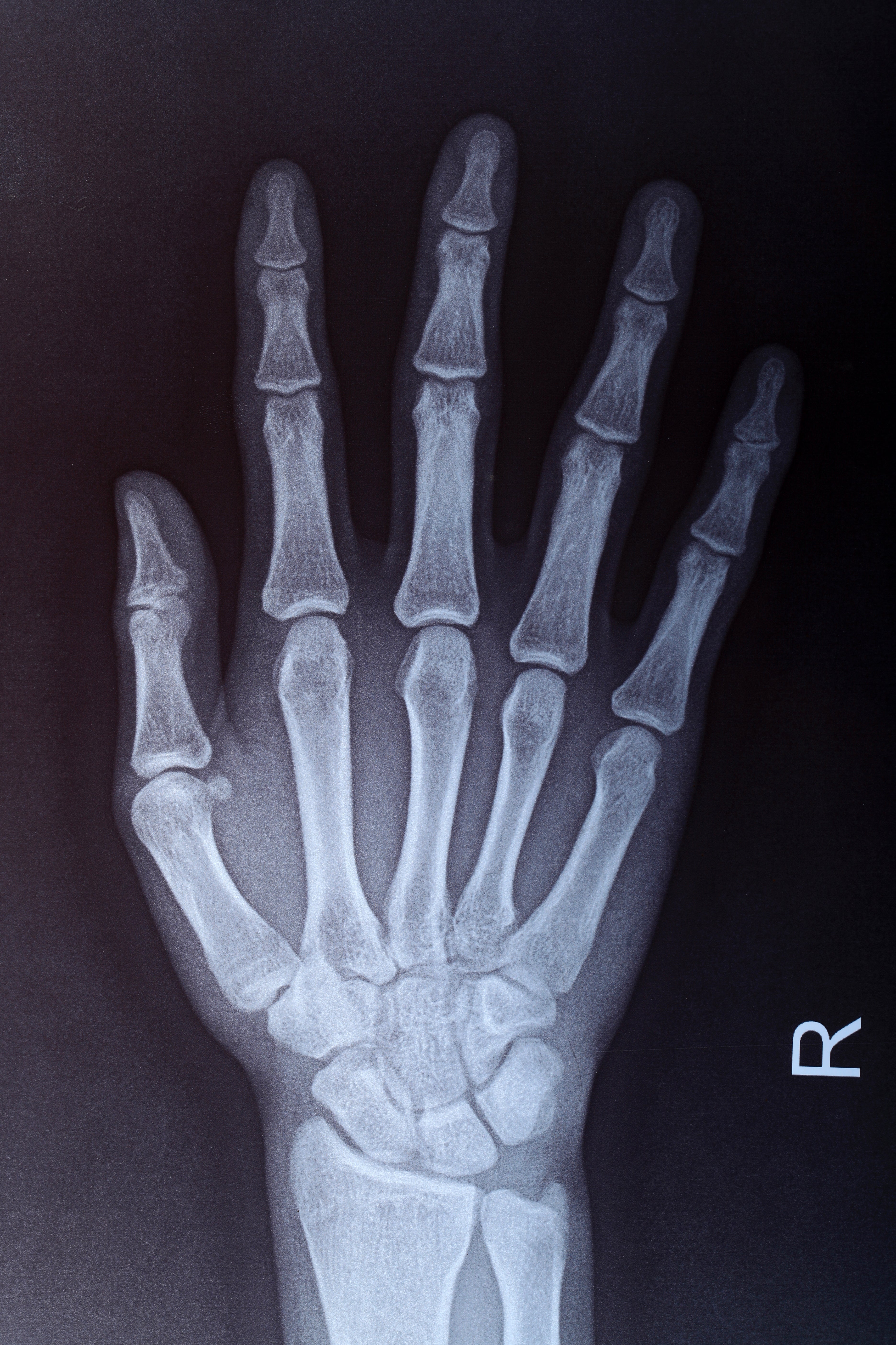 Post image 3