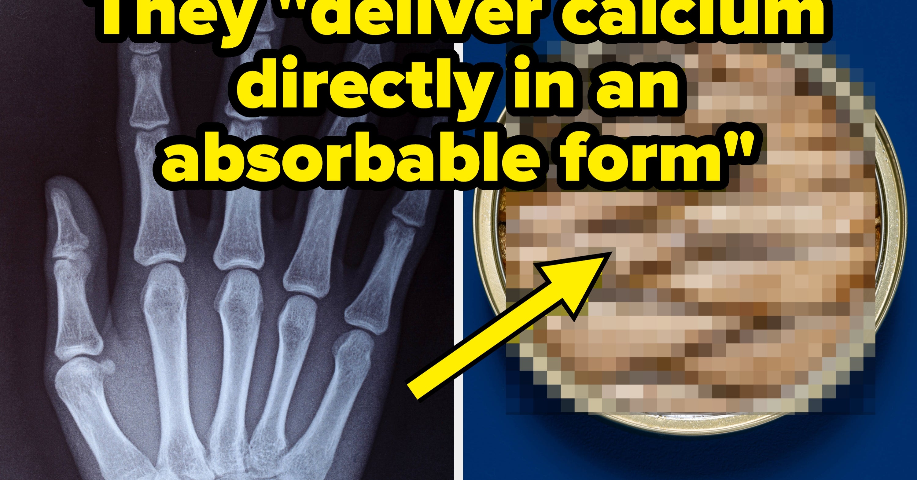 Osteoperosis "Is Largely Preventable," According To Bone Health Experts. Here's How To Avoid It