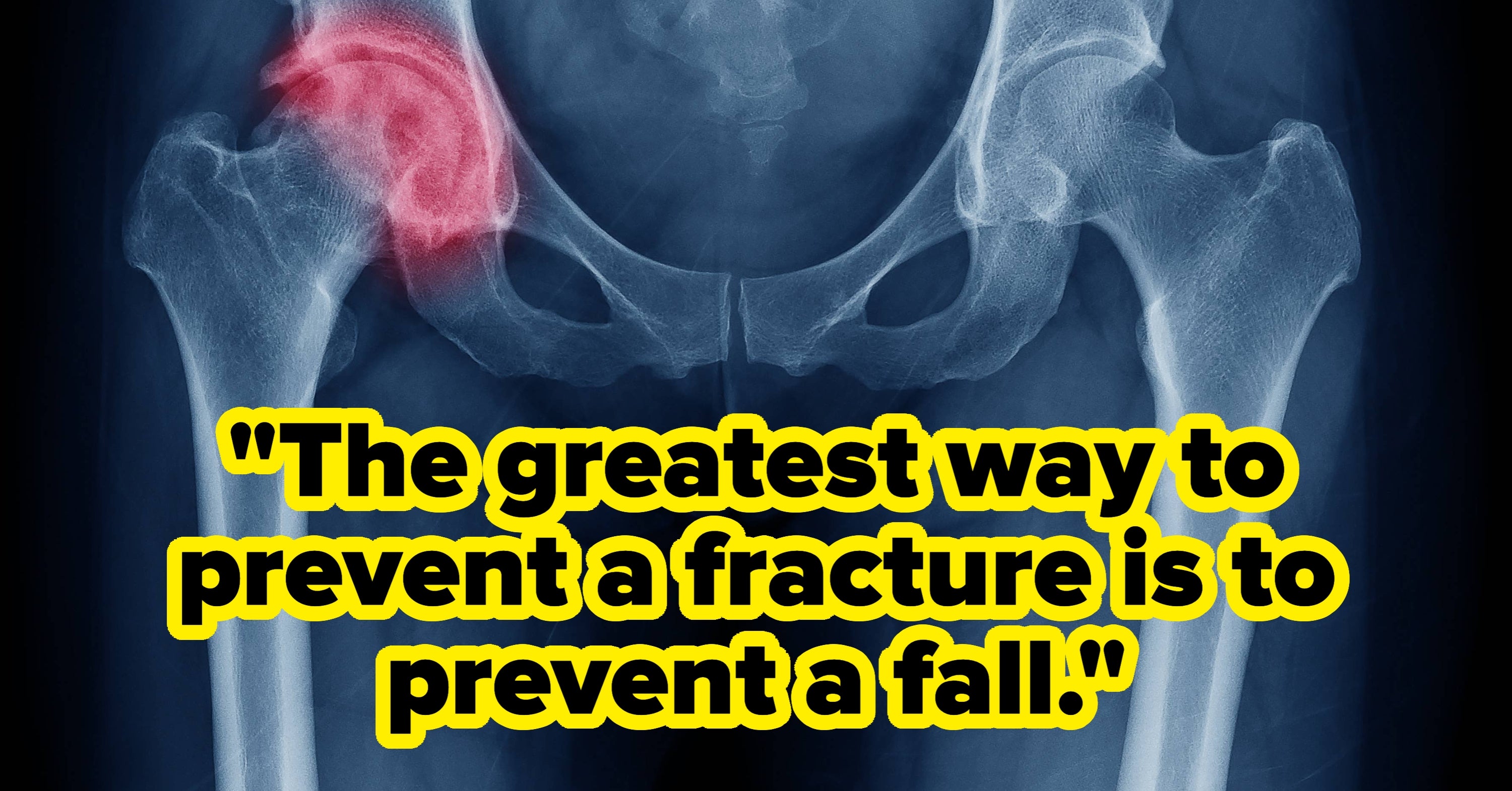 If You Can't Balance On One Leg For More Than 10 Seconds, Doctors Say Your Health Might Be In Trouble. Here's How To Fix It