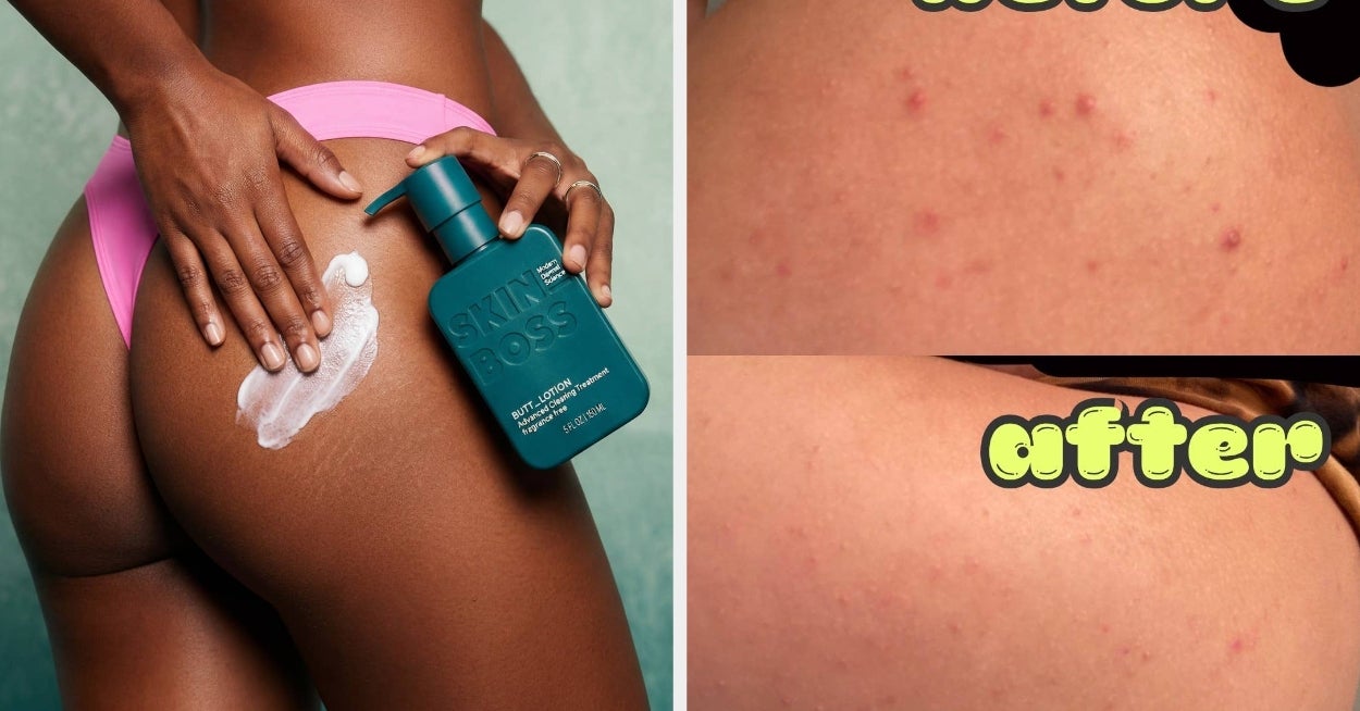 27 Skincare Products For All The Acne That’s *Not* On Your Face