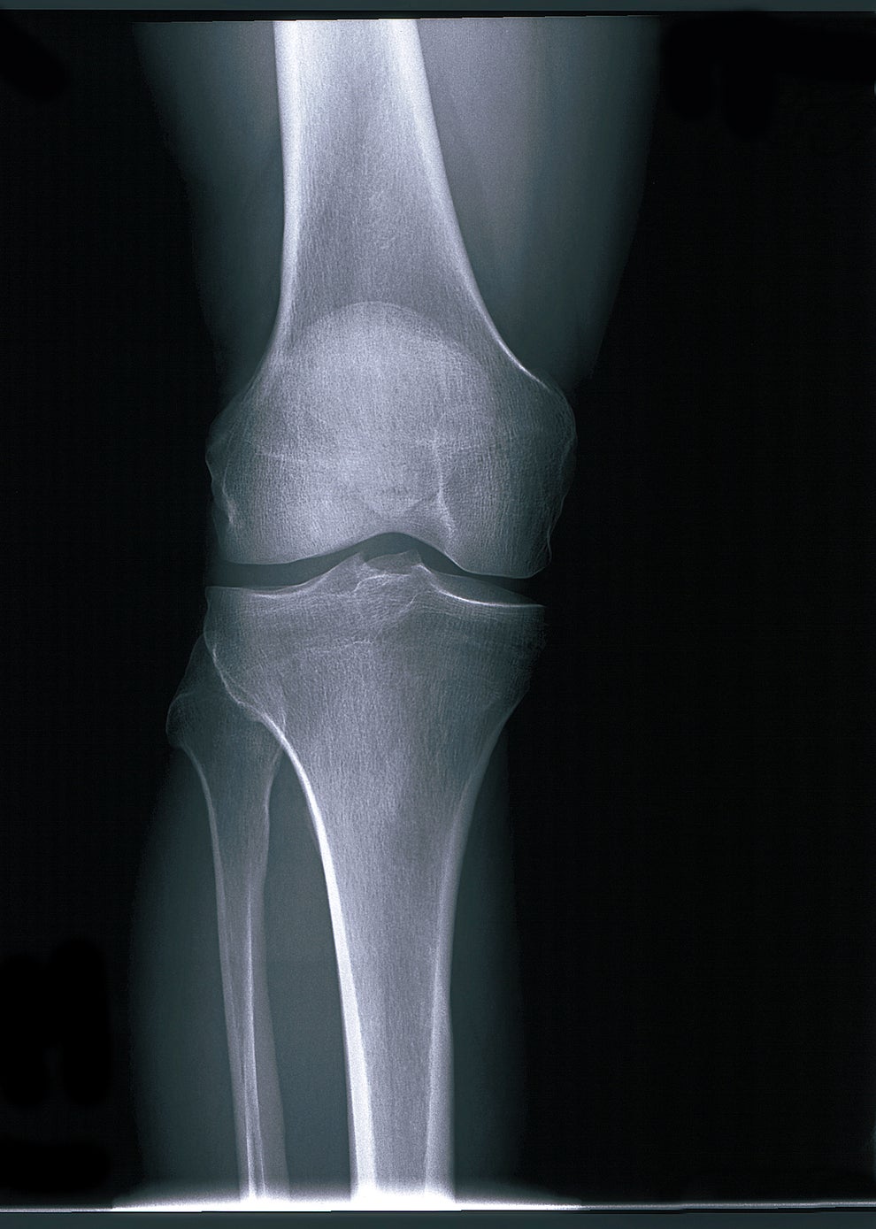 Post image 9