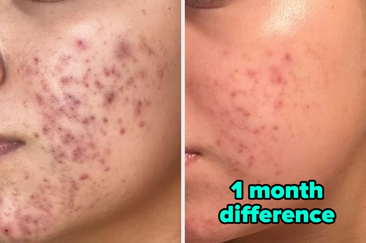 35 Korean Beauty Products With Such Undeniable Results, You’ll Wish You Started Using Them Ages Ago