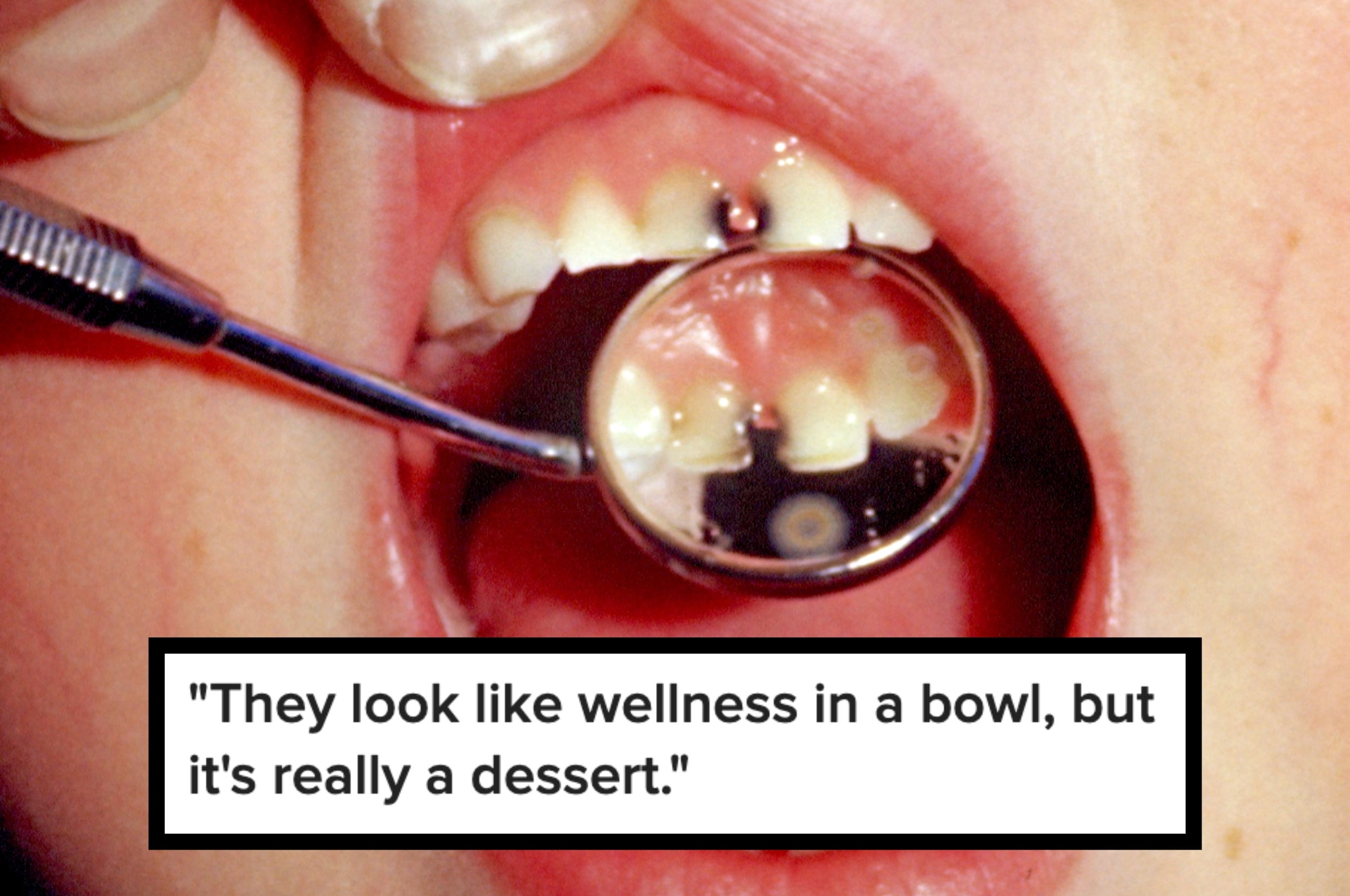 Close-up of a dental examination with a quote about dessert