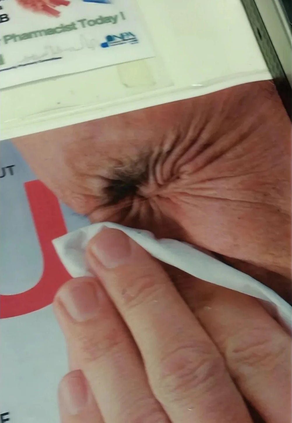 Man sneezing into a tissue, with portion  of a mag  screen  visible