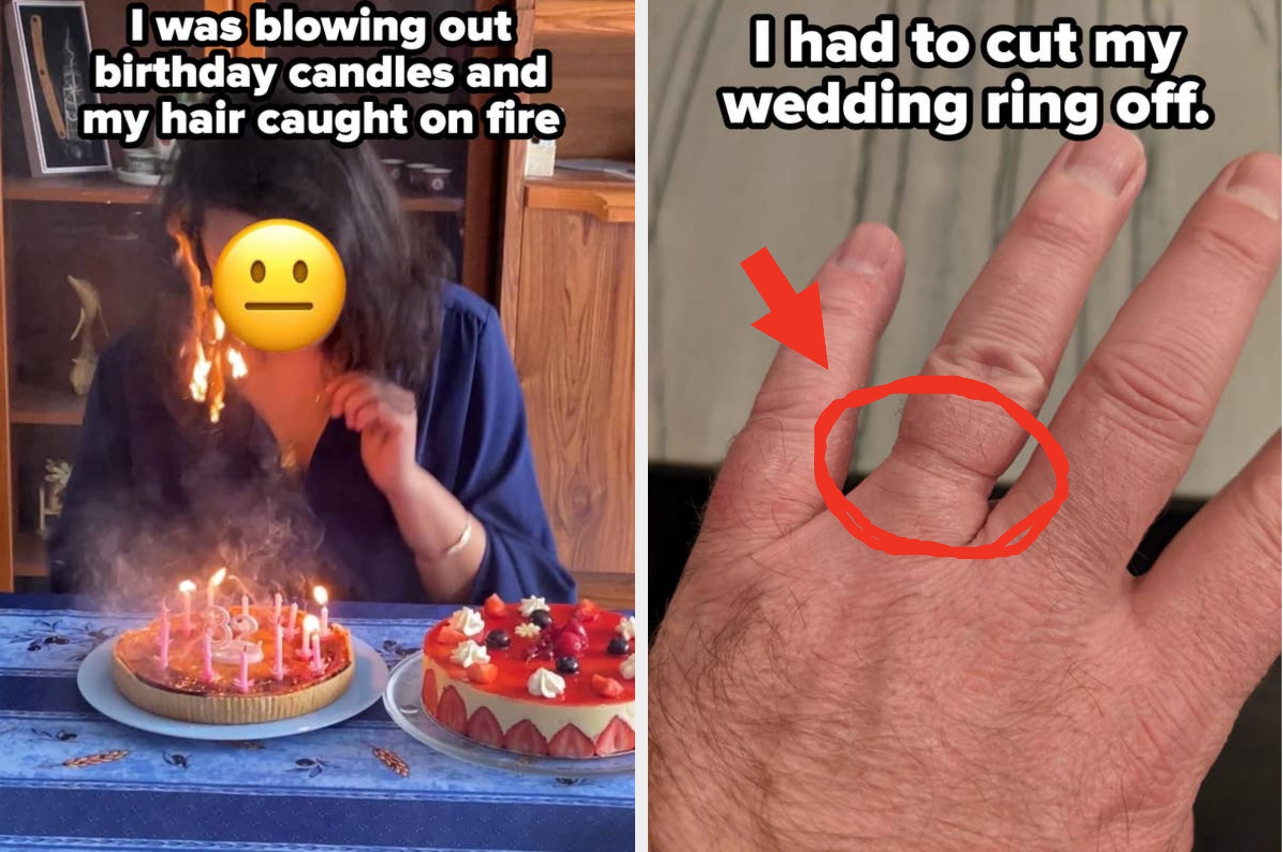 Left: Person blowing out birthday candles with hair catching fire. Right: Hand with a ring removed, circled in red