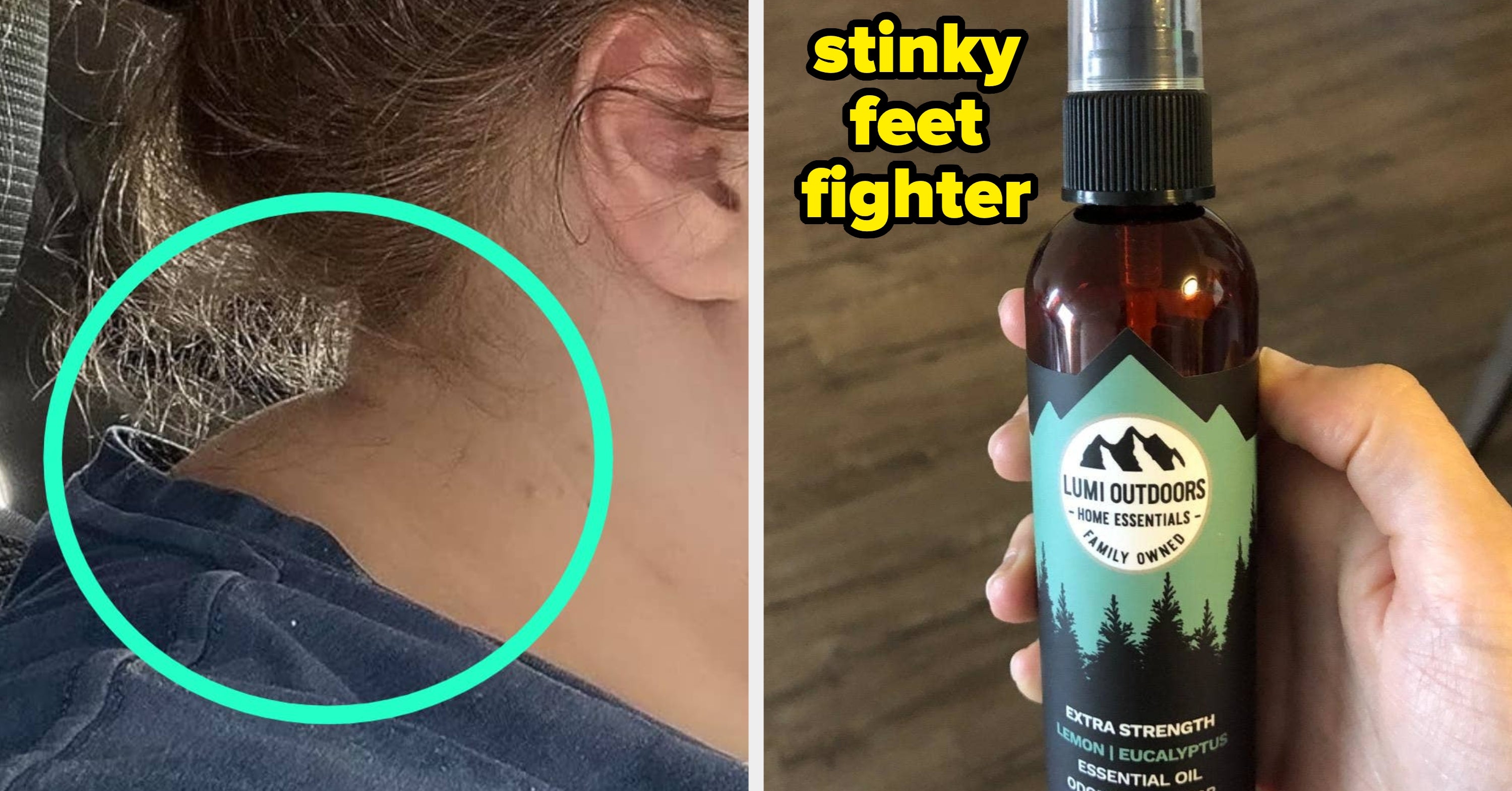 Got Annoying Body Problems You've Been Dealing With For Months? Start Tackling Them With These 37 Products