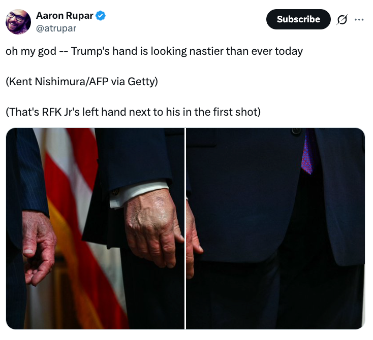 Split image of two hands; one appears aged and wrinkled. Social media post discussing the hands with reference to RFK Jr