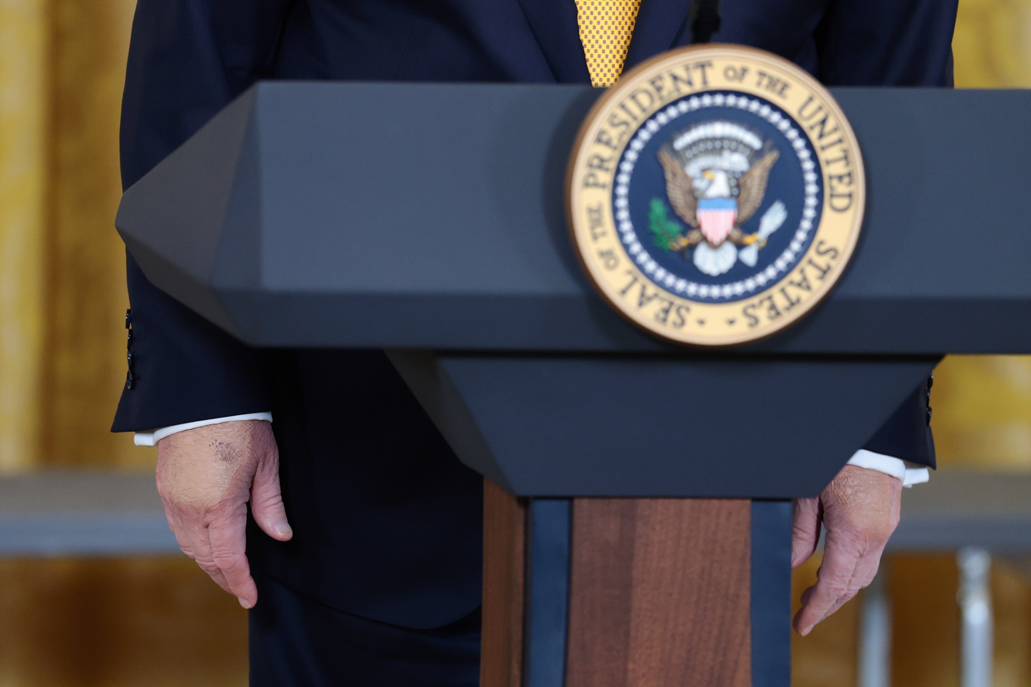 Donald Trump standing behind a podium with the seal of the President of the United States, visible hands resting at the sides. Both hands are bruised and have the bruises covered with makeup, the color of which does not match his skin tone