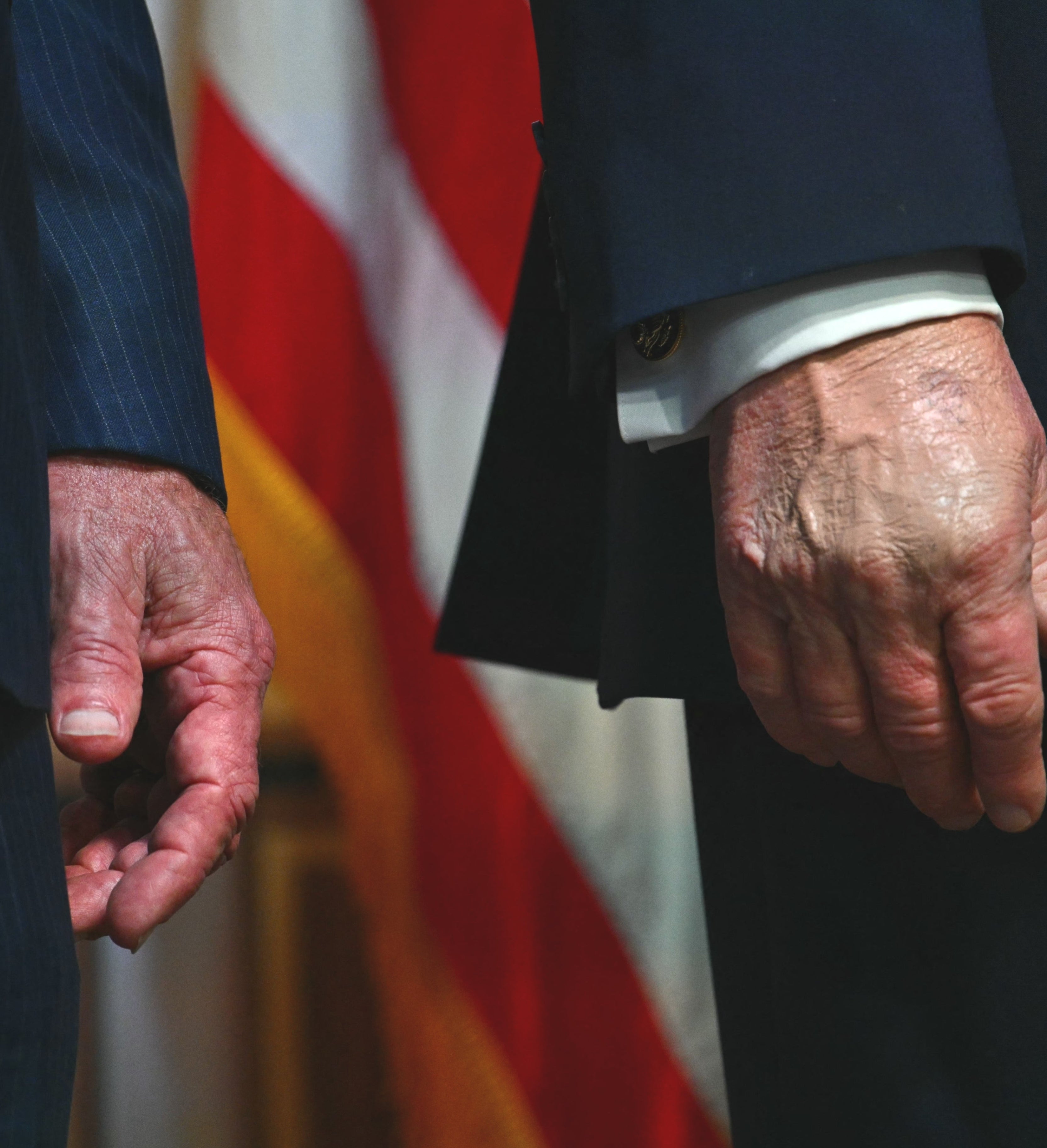 Close up of Donald Trump's hand, visibly bruised and covered in makeup