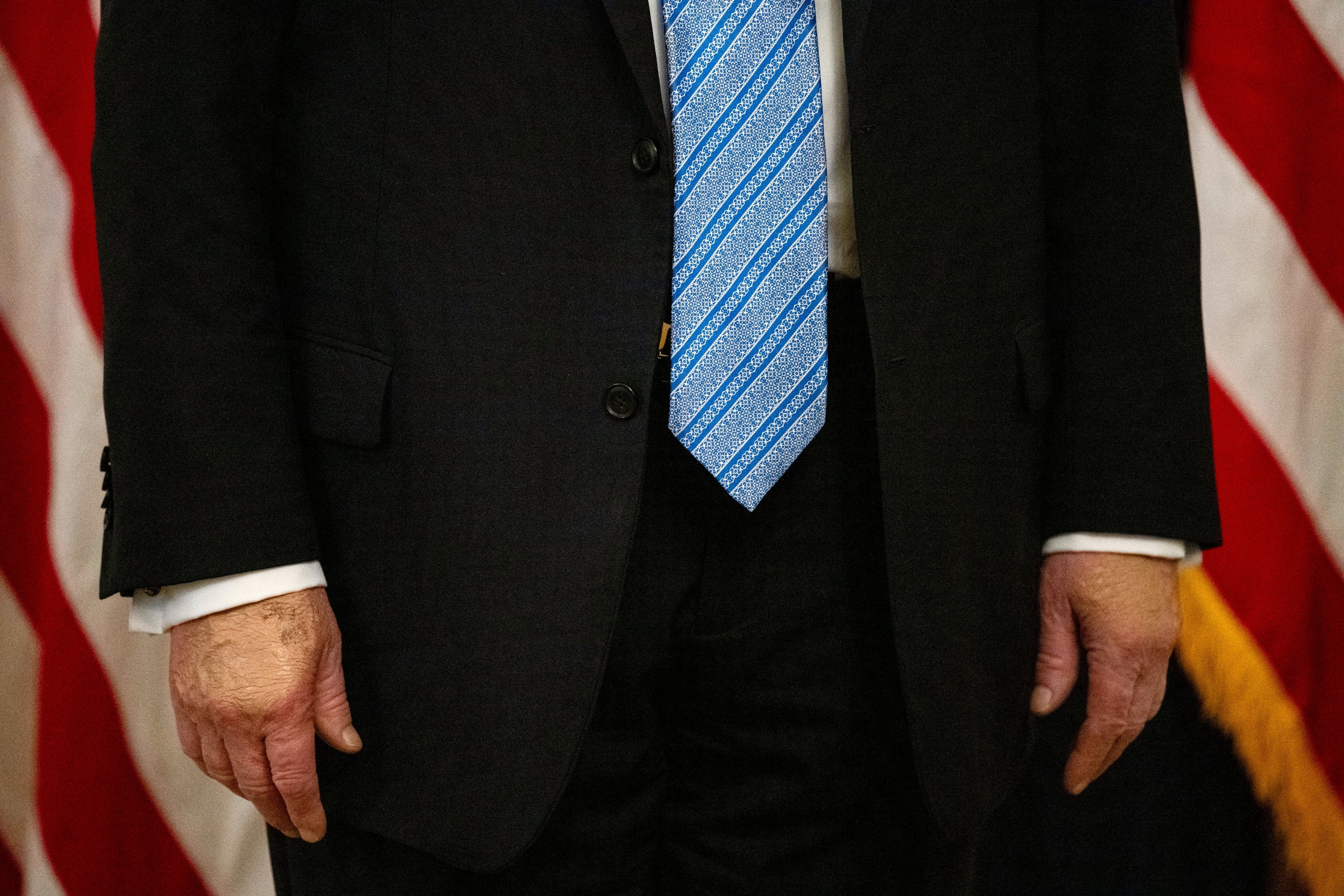 Donald Trump in formal suit with a patterned tie, standing in front of flag backdrop; his right hand has makeup on it to cover his bruising