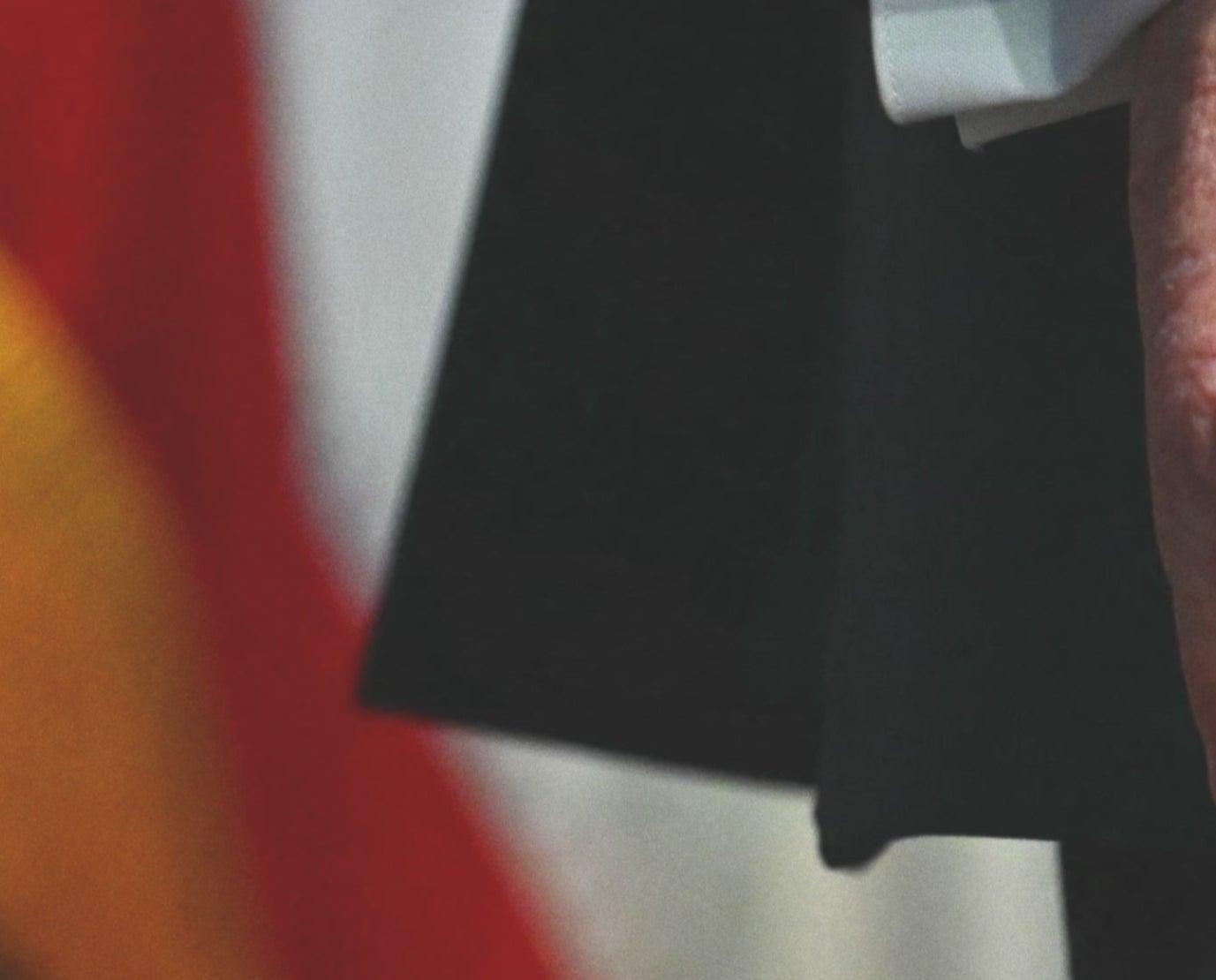 Even Closer close up of Donald Trump's hand, visibly bruised and covered in makeup