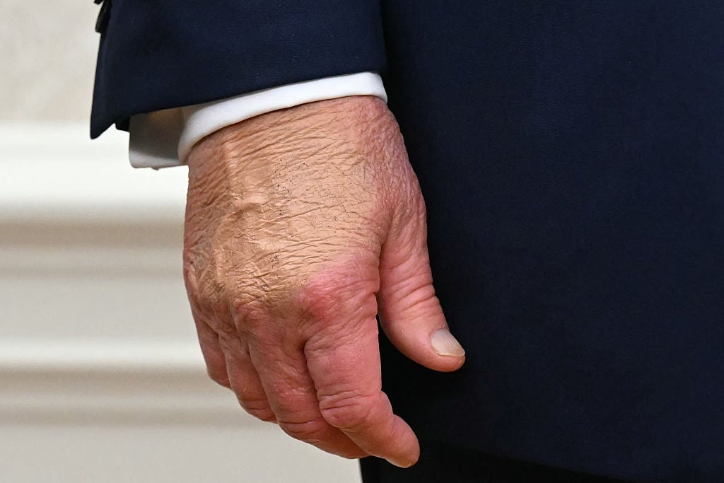 A close-up of an older person's hand with wrinkled skin, wearing a dark suit with a white shirt cuff peeking out