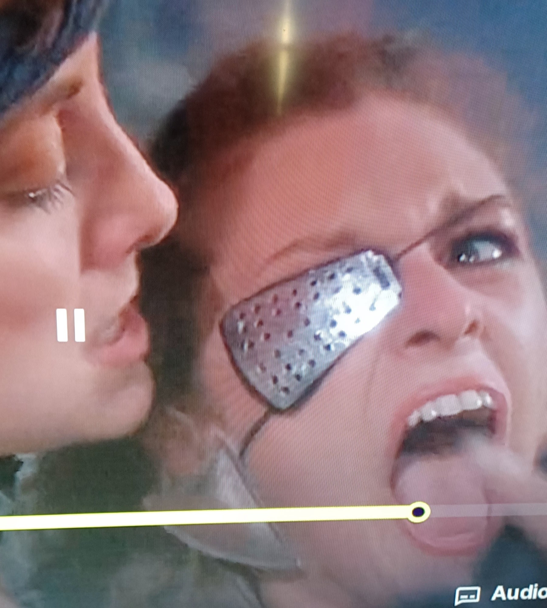 A woman appears distressed, wearing a silver eye patch, while another person is close, possibly offering comfort