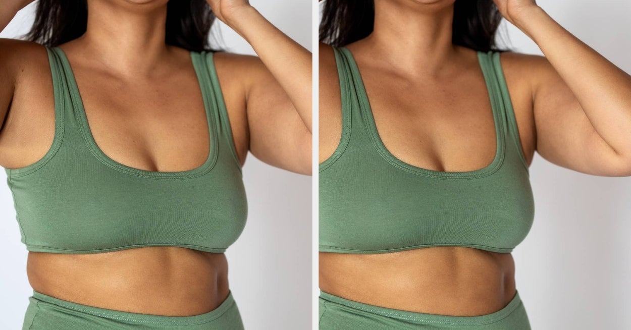PCOS Is Getting A New Name, And Women All Over America Have Lots Of Thoughts About It