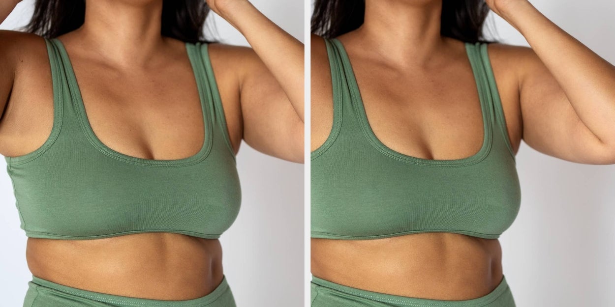 Why PCOS Is Getting Renamed—And What It Means