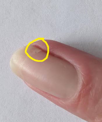 Close-up of a finger with a hangnail on the side of the nail