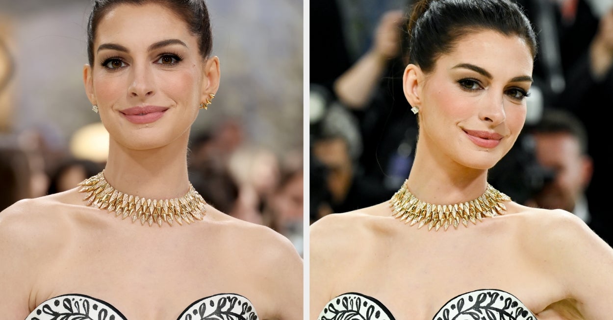 After Posting Her Viral "Trick" For Looking More "Awake," Anne Hathaway Addressed Plastic Surgery Rumors