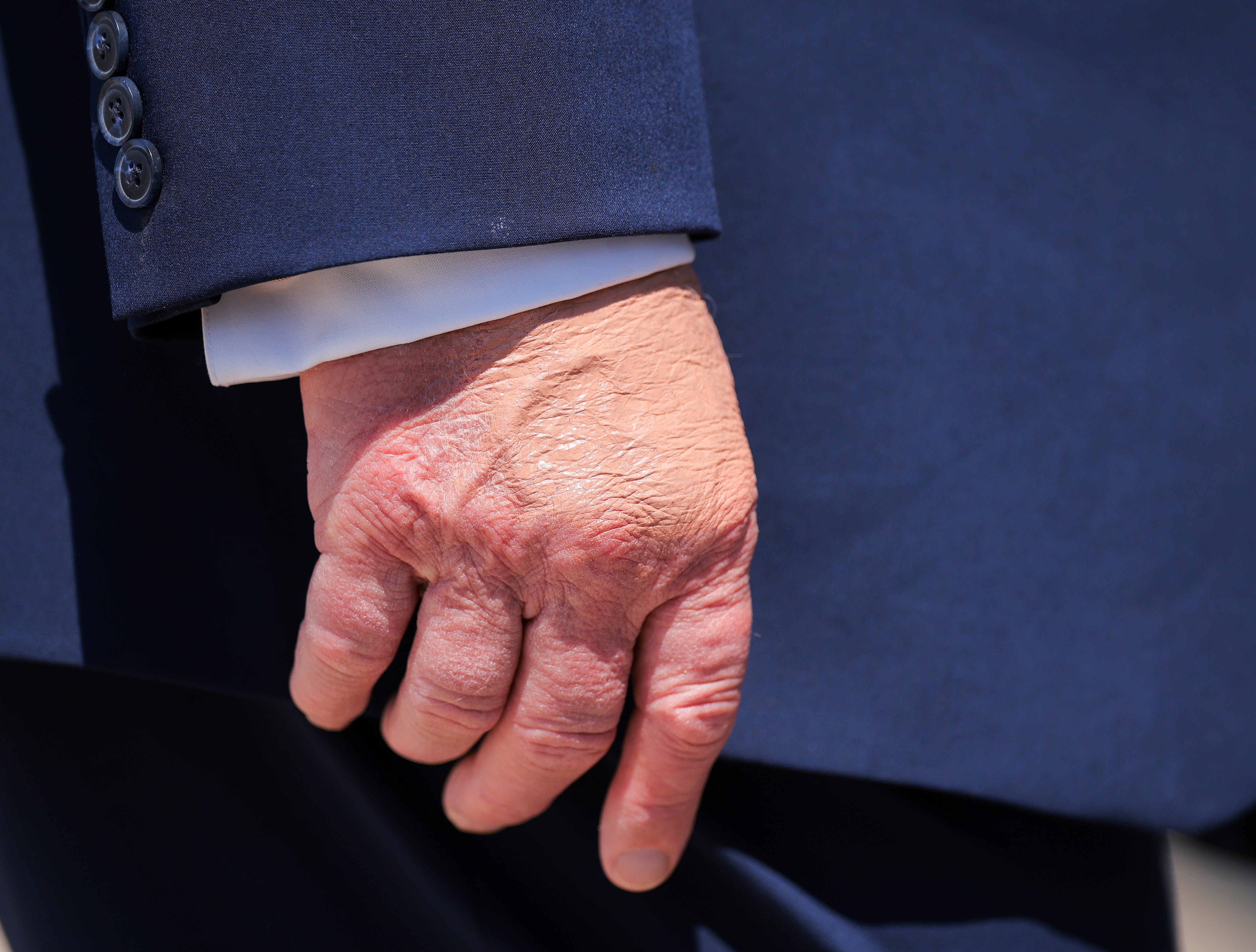 Close-up of Donald Trump's hand near his pocket, showcasing intricate skin details (makeup and swelling) and a neatly tailored suit sleeve