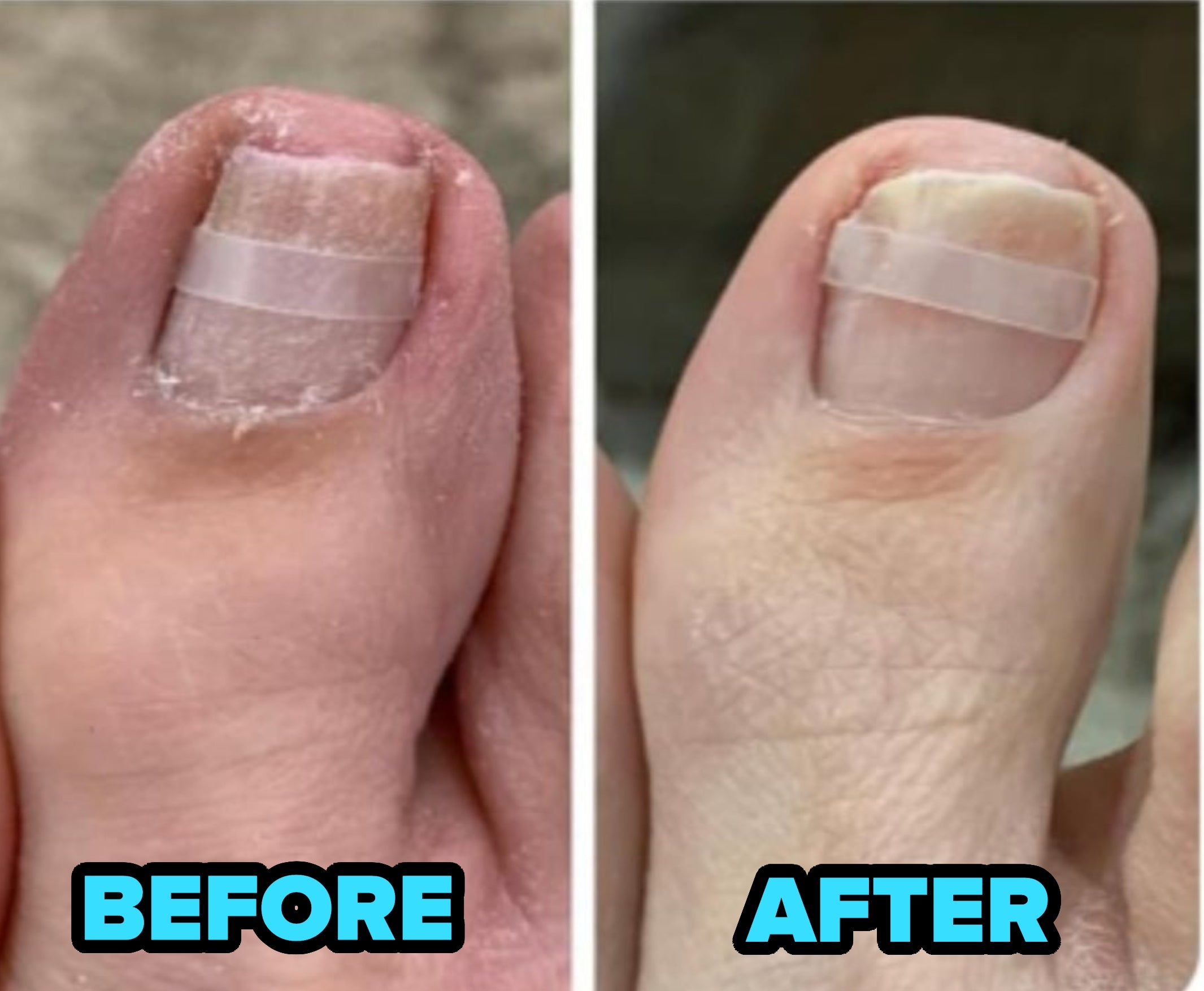 Four sets of toenails showing "before and after" images of pedicure transformations, with noticeable improvements in nail grooming