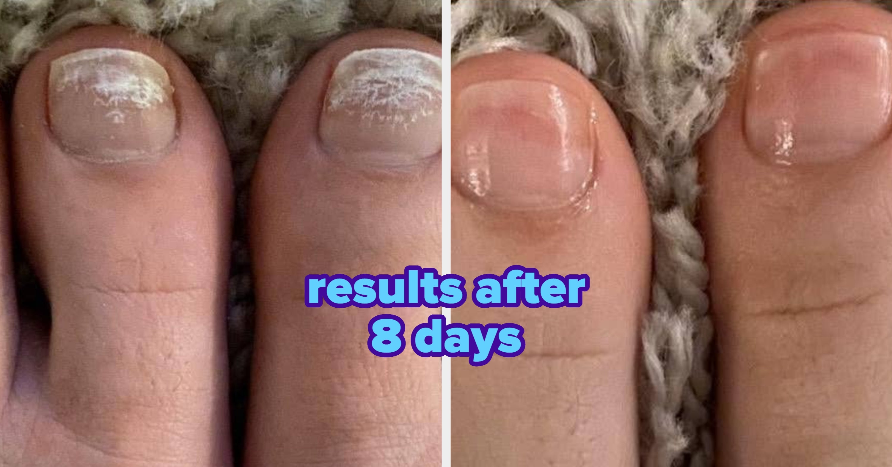 These 41 Products Will Make You Realize That Some Your Body Annoyances Don't Have To Be Permanent