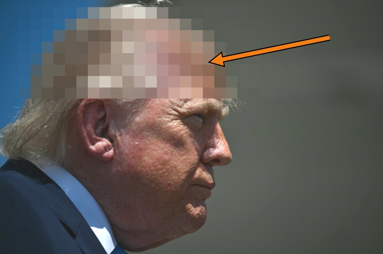 Person with pixelated face and arrow pointing at forehead under bright light
