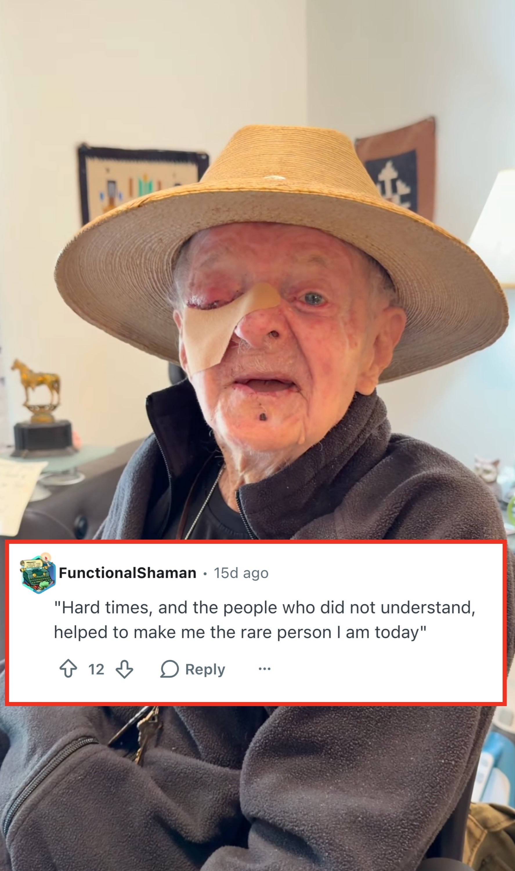 A idiosyncratic   wearing a wide-brim chapeau  and a overgarment   sits indoors, with a bandage connected  their nose, expressing a calm demeanor