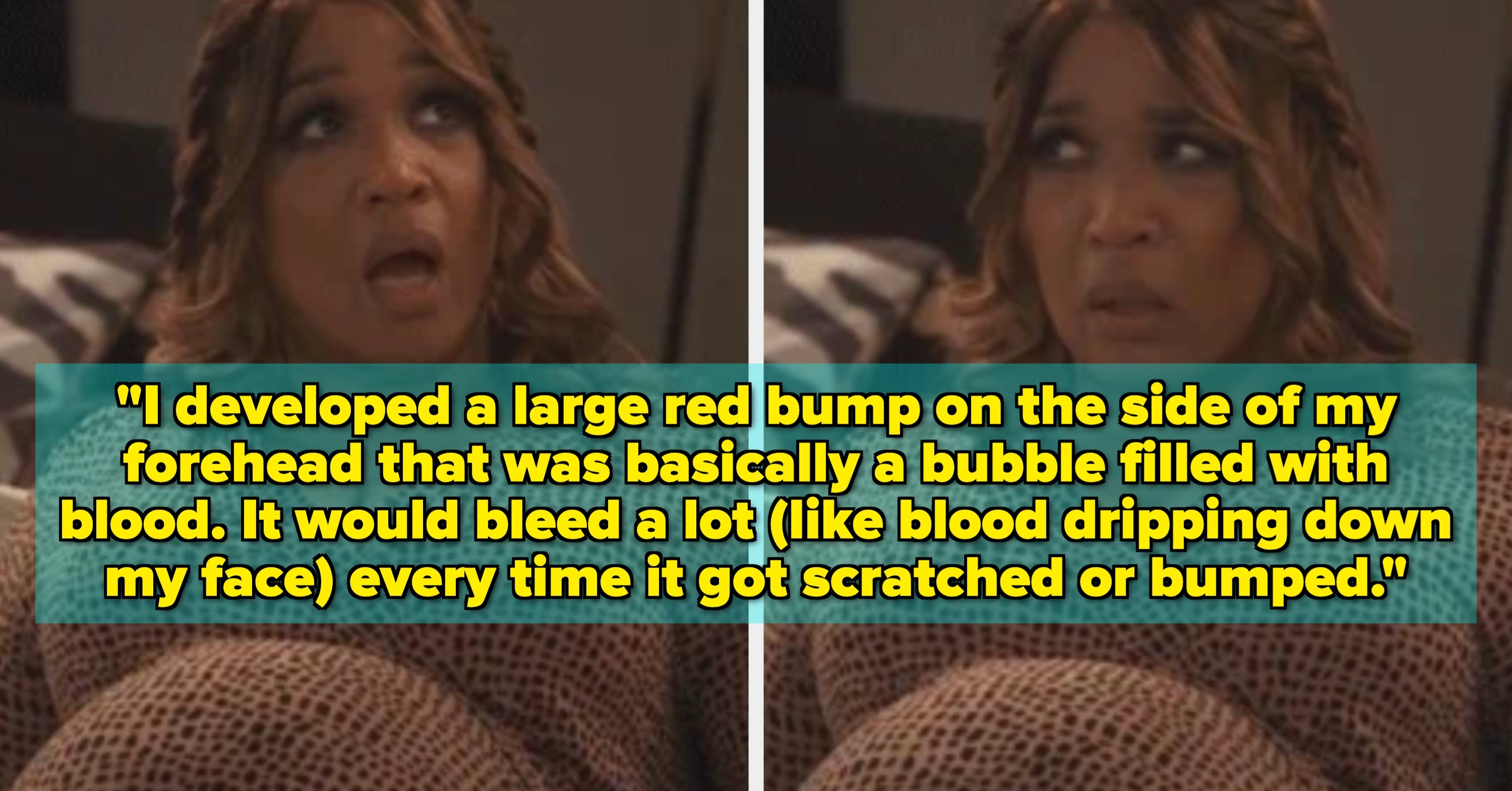 "I Developed A Large Red Bump On The Side Of My Forehead That Was Basically A Bubble Filled With Blood": These 34 People Are Sharing Their Oddest Pregnancy Symptoms, And Let Me Just Say...Wow
