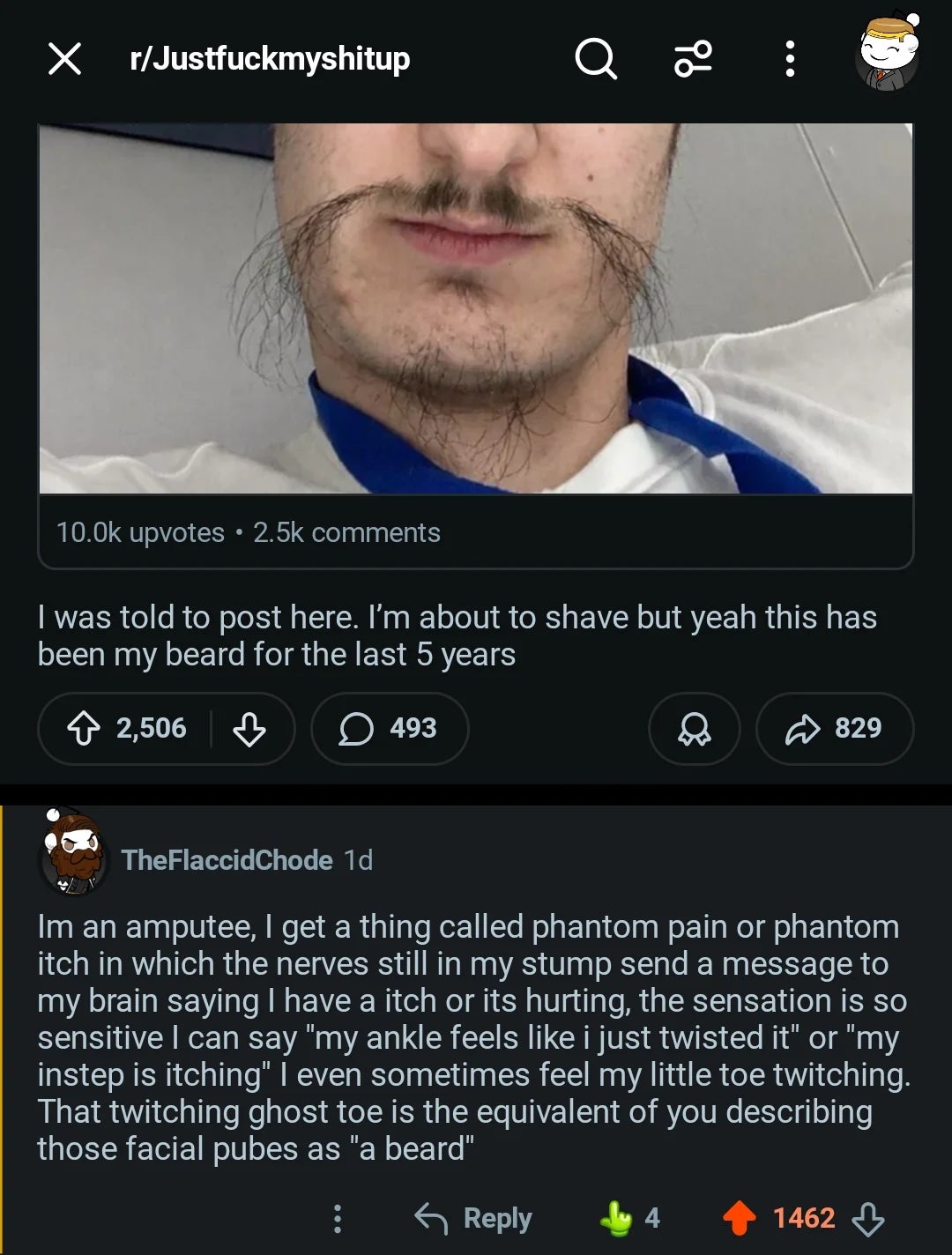 Close-up of a antheral   with a partially shaved beard and twisted end. Comment compares the sensation to phantom symptom  post-amputation